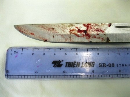 Bị kiếm đâm xuyên qua mắt 9,5cm vẫn thoát chết hy hữu - 2