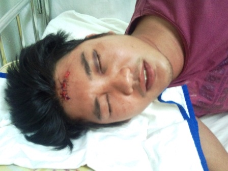 Hai cậu cháu bị chém dã man ngay trước nhà - 2