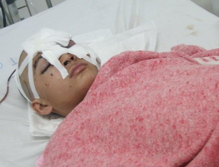 2 bệnh nhân bị thương rất nặng đã qua cơn nguy kịch - 3