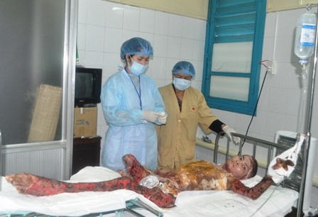 Cứu sống bệnh nhân bỏng nặng 70% - 1 Cứu sống bệnh nhân bỏng nặng 70% - 1