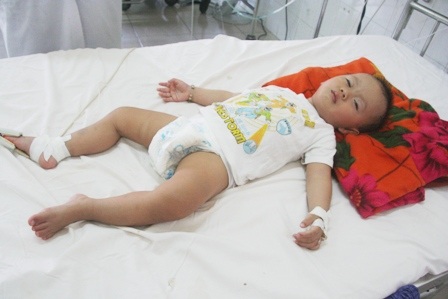 Cứu sống 20 bệnh nhi bị chân tay miệng nặng