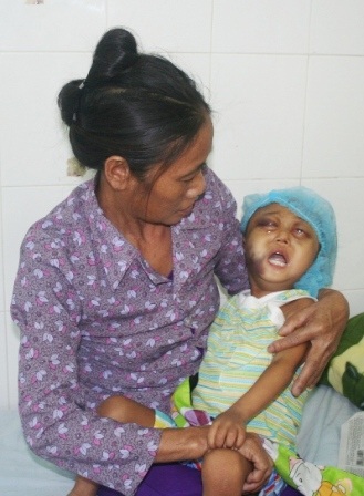 Nghẹn lòng trước đôi mắt cháu bé 3 tuổi bị ung thư máu 