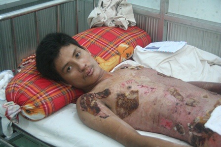 Trao hơn 11 triệu đồng đến gia đình bị bỏng nặng - 1 Anh Vũ gửi lời cảm ơn đến báo Dân trí và bạn đọc gần xa đã giúp gia đình rất nhiều sau tai nạn