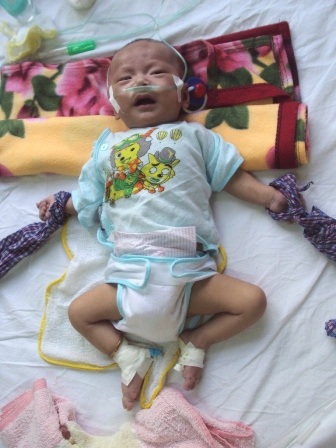 Bé 4 tháng tuổi chống chọi với bệnh tim hiểm nghèo - 1 Cháu Chiến trên giường bệnh lúc ở tại khoa Nhi cấp cứu, BV Trung ương Huế