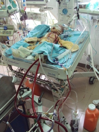 Hình ảnh mới nhất của cháu ở Khoa Gây mê hồi sức Tim, tầng 5 Trung tâm Tim mạch, BV Trung ương Huế