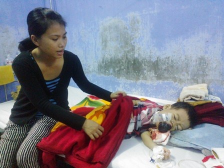 Sự sống mong manh của bé 3 tuổi bị ung thư xương hàm miệng - 4 Người mẹ suốt ngày ngồi bên con dỗ dành cho con khỏi đau