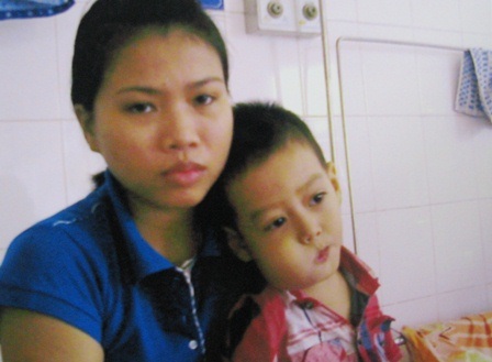 Sự sống mong manh của bé 3 tuổi bị ung thư xương hàm miệng - 2 Trước đó 2 tháng lúc cháu mới nhập BV Trung ương Huế