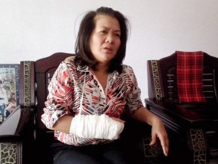 Trưởng đoàn bóng đá Huế bị ''tố'' bạo hành vợ - 1 Bà Lan đau đớn kể lại sự việc bị chồng đánh gãy tay