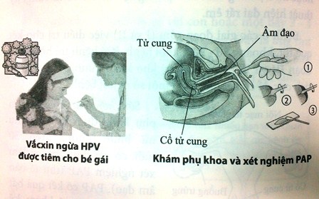 Cấp bách vấn đề dự phòng - điều trị ung thư cổ tử cung - 3 Hội thảo quốc tế “Dự phòng và điều trị ung thư cổ tử cung” tại trường ĐH Y - Dược Huế