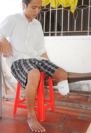 Bệnh nhân đòi bệnh viện... trả chân - 1 Bệnh nhân đòi bệnh viện... trả chân - 1