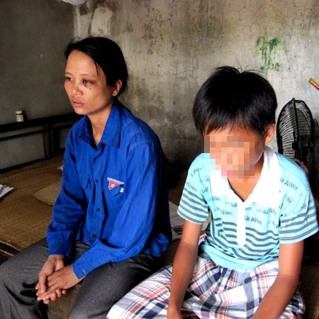 Lời kêu cứu của người phụ nữ sau 14 năm bị chồng bạo hành - 2 Lời kêu cứu của người phụ nữ sau 14 năm bị chồng bạo hành - 2