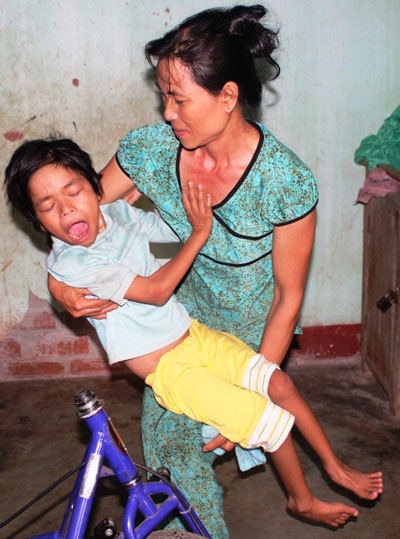 Da cam - nỗi đau bao giờ nguôi ngoai! - 4 Da cam - nỗi đau bao giờ nguôi ngoai! - 4