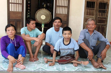 Da cam - nỗi đau bao giờ nguôi ngoai! - 1 Da cam - nỗi đau bao giờ nguôi ngoai! - 1