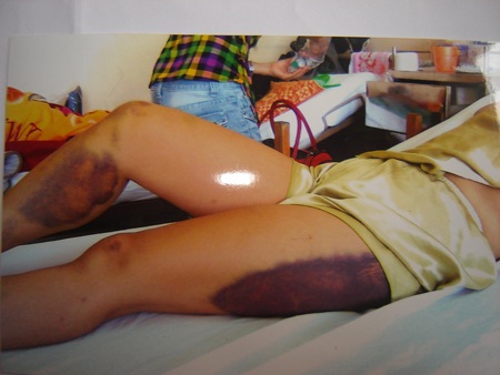 Sắp xét xử hai điều tra viên dùng nhục hình bức cung - 2