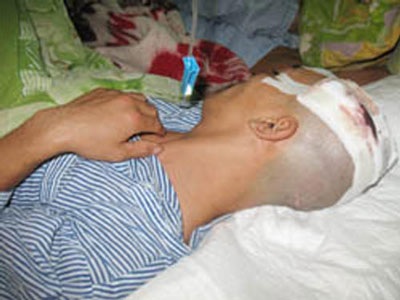 Đi đưa dâu, 1 thanh niên bị chém vỡ xương sọ - 1 Đi đưa dâu, 1 thanh niên bị chém vỡ xương sọ - 1