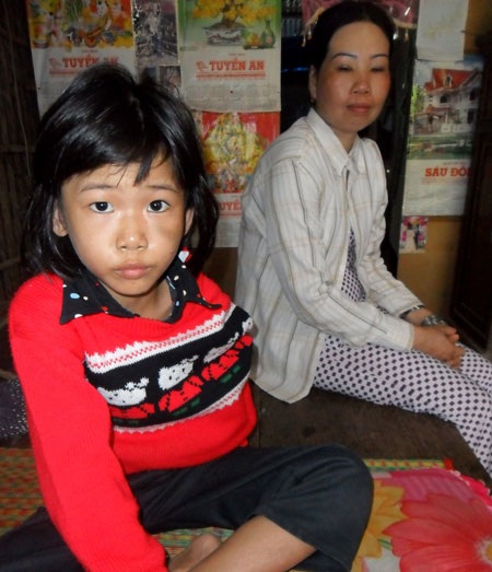 Mẹ dùng bẹ dừa đánh con gãy tay - 1