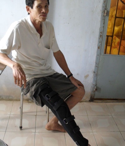 Người dân tố bị công an xã đánh tàn tật vì không đội mũ bảo hiểm - 1 Người dân tố bị công an xã đánh tàn tật vì không đội mũ bảo hiểm - 1