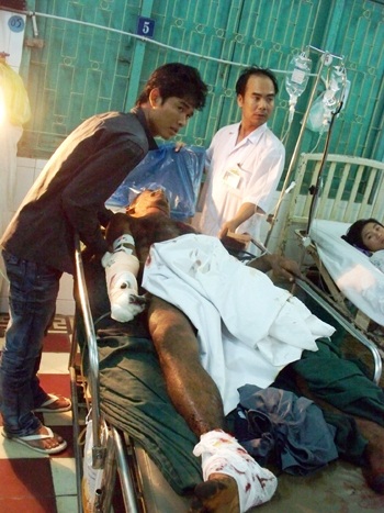 Hai người thương vong do mìn phát nổ khi đốt rẫy - 1 Hai người thương vong do mìn phát nổ khi đốt rẫy