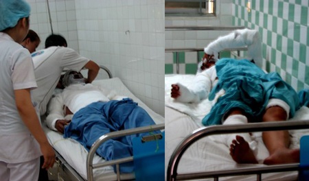 Đôi tình nhân bị tạt axít trong phòng trọ - 1