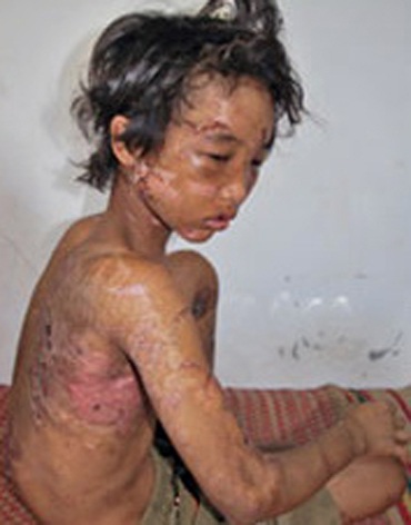 Cuộc sống mới của Hào Anh - 2 Hào Anh gần ba năm trước - Ảnh tư liệu