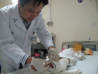 Bé gái gần đứt lìa bàn chân vì miếng chắn pô xe máy