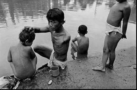 Ai đã từng khóc khi xem những bức ảnh này? - 8 Cho dù cha chỉ còn lại 1 tay và 1 chân...