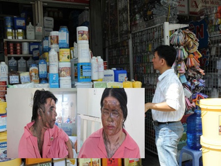 Vợ chồng anh Phạm Quang Thược bị tạt axít tối 27-1 (ảnh nhỏ).