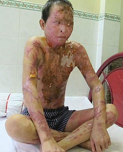 Anh Nguyễn Quốc Tuấn. Ảnh: Phạm Dũng