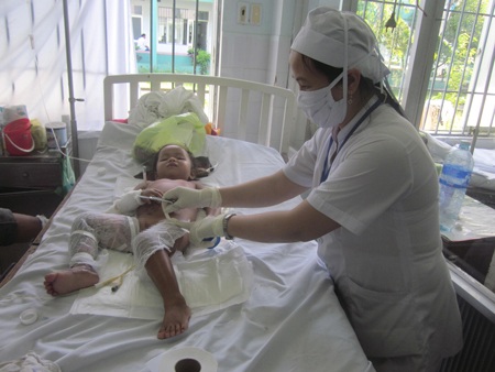 Thảm kịch đầu năm ập xuống một gia đình nghèo - 3 Chị Dinh và cháu Châu bị bỏng nặng