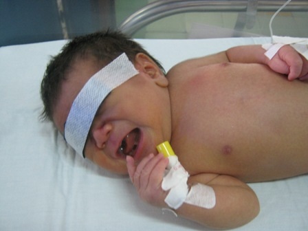 Cháu bé vượt qua nhiều cửa ải tử thần