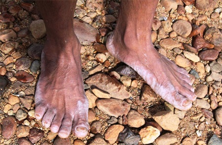 Một đôi chân ngâm cả ngày dưới nước