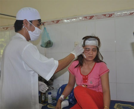 Hai du khách kinh hãi vì bị khỉ độc tấn công - 2 Hai vết thương do khỉ độc tấn công