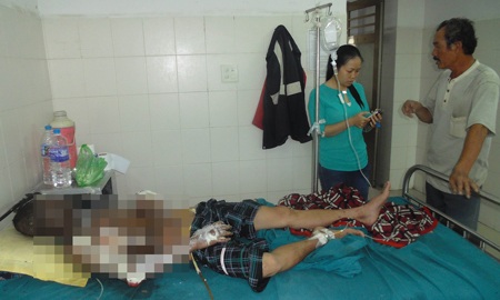 Nổ chảo dầu đang sôi, một người bỏng nặng - 1 Bệnh nhân Kỳ bị bỏng nặng do chảo dầu rái đang sôi bỗng nhiên phát nổ