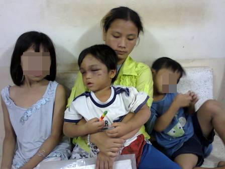 Bé trai 3 tuổi bị bạo hành: Khẩn trương tìm đưa cháu vào “nhà tạm lánh” - 2 Khó tước quyền nuôi con của Nở trong vụ việc này