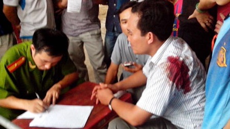 Giật mình: Nhiều CSGT phải điều trị tâm thần - 3 Vụ CSGT tại tỉnh Thanh Hóa nổ súng bắn người vi phạm giao thông trên đường.