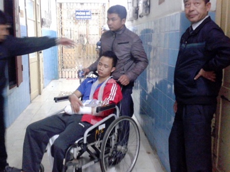 Pháo hoa que phát nổ, một thanh niên bị dập nát bàn tay - 1 Pháo hoa que phát nổ, một thanh niên bị dập nát bàn tay