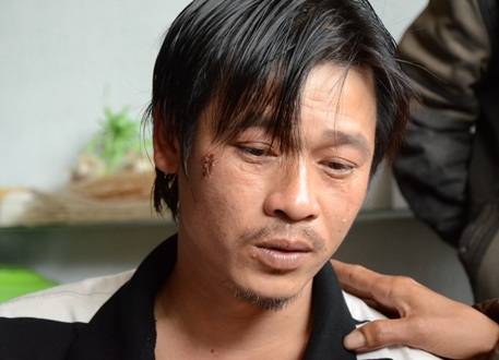 Nổ bình gas trên tàu cá: Nước biển xanh biến thành màu máu đỏ - 3 Ngư dân Ngô Ngọc Trung bật khóc khi kể lại giây phút kinh hoàng trên biển