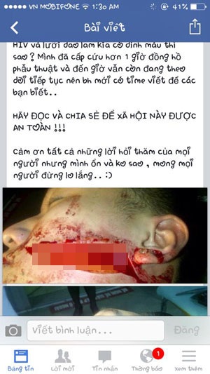 Nam sinh bị rạch mặt dã man, lên Facebook kêu gọi cảnh giác - 1 Lời kêu gọi cảnh giác của B. trên trang cá nhân của mình đang nhận được hànhg nghìn lượt chia sẻ.