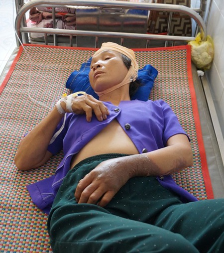Bà Chuổi nằm điều trị tại TTYT Châu Thành.