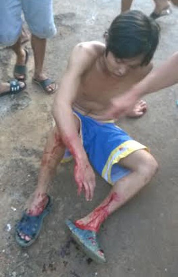 Nạn nhân bị bắn sau cuộc hỗn chiến trên phố (Ảnh: Lê Văn)