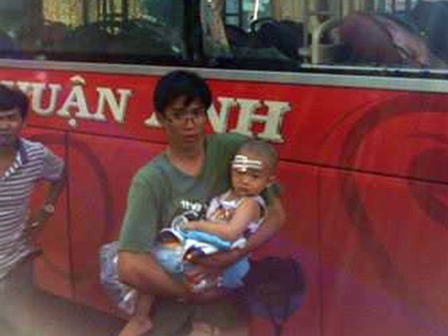 Bé Nguyễn Phan An Khang được sơ cứu trước khi vào TPHCM chữa trị.