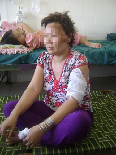 Đốt đầu vợ để… xóa hình ảnh người tình - 1