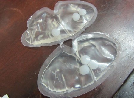 Hai túi dung dịch chứa “hạt lạ” được chị T. phát hiện trong áo ngực