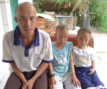 Lạ lùng gia đình “trọc đầu” qua 3 thế hệ - 1 Cháu Thư và cháu Muội (đời thứ 3) đầu không còn nhẵn trụi nữa nhưng chỉ lơ thơ như thế này