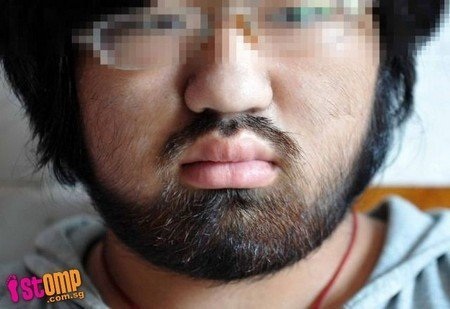 Uống thuốc mạnh, thiếu nữ mọc đầy râu, lông - 1 Nana đau khổ khi bỗng nhiên trở thành 'đàn ông'