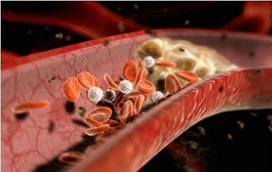 Đừng xem thường các triệu chứng "bình thường" hay gặp! - 1 Đừng xem thường các triệu chứng bình thường hay gặp!