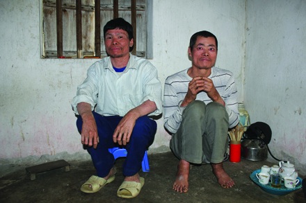 Hai anh em ông Đô và Tô đang kể về bệnh tình.