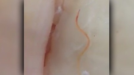 Cận cảnh con giun còn sống