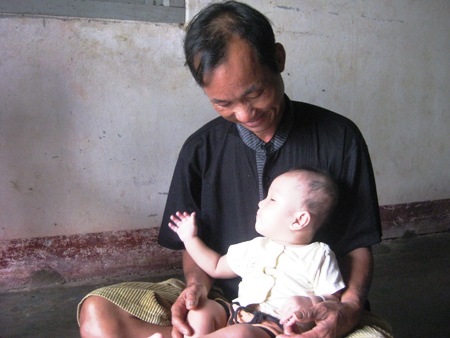 Bé 2 tuổi mơ tìm lại ánh sáng cho đôi mắt