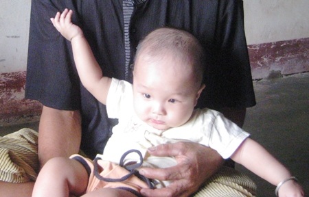 Bé 2 tuổi mơ tìm lại ánh sáng cho đôi mắt